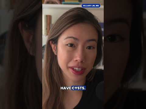 PCOS was never just about cysts