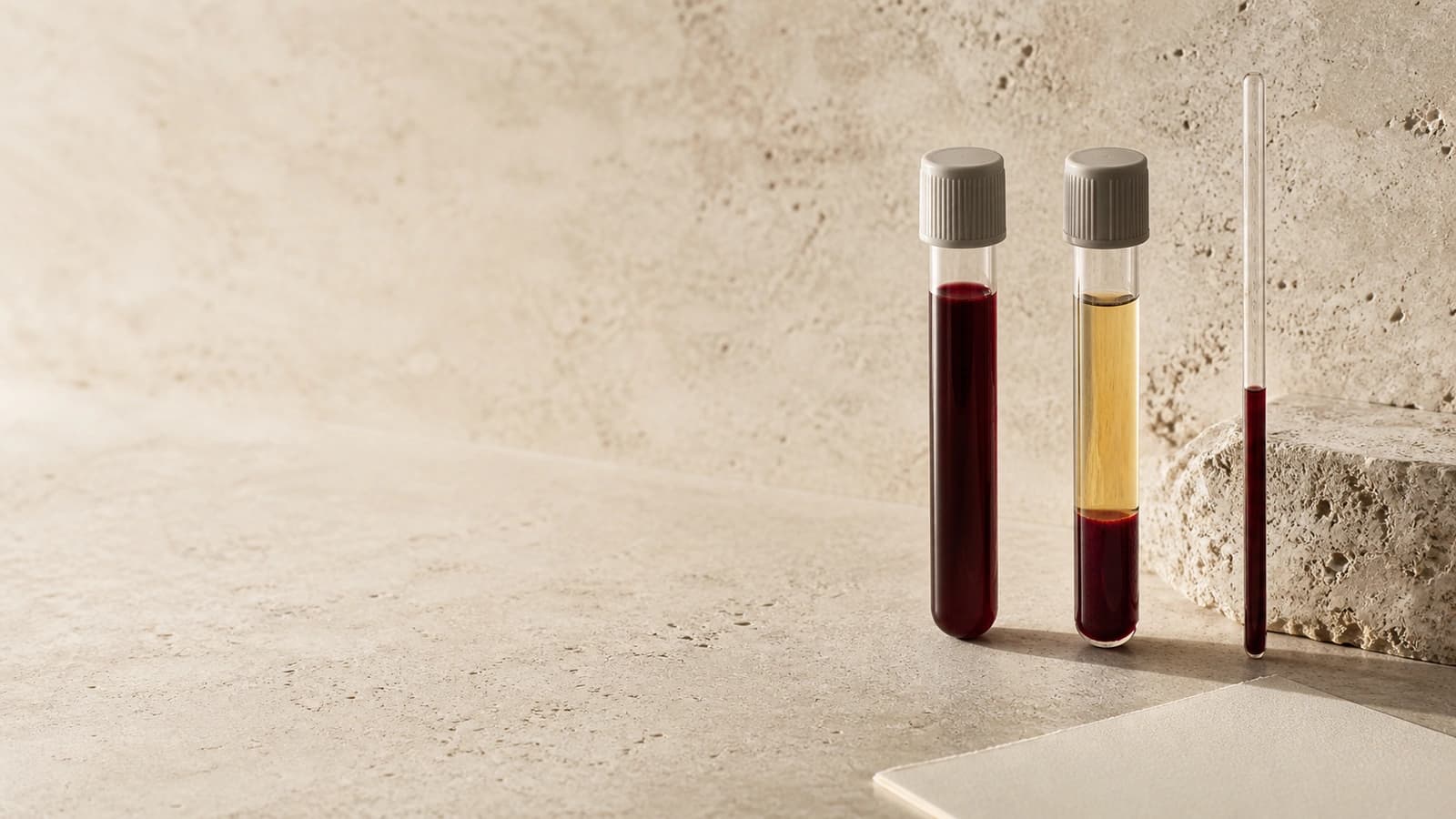 Whole blood, separated serum, and a sedimentation sample arranged on a warm stone surface.